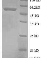 Escherichia coli 30S ribosomal protein S2 (rpsB) Recombinant Protein, N-GST - BioCrest Sci