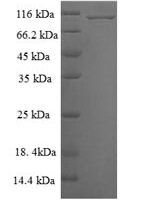 Human Mitogen-activated protein kinase 6 (MAPK6) Recombinant Protein - BioCrest Sci