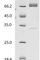 Human HERV-H LTR-associating protein 2 (HHLA2), partial, Biotinylated Recombinant Protein - BioCrest Sci