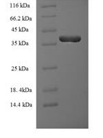 Human Granulocyte-macrophage colony-stimulating factor (CSF2) Recombinant Protein, N-GST - BioCrest Sci
