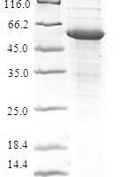 Human Craniofacial development protein 1 (CFDP1) Recombinant Protein - BioCrest Sci