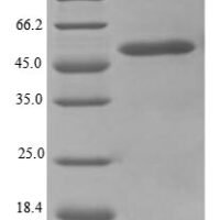 Mouse Trifunctional enzyme subunit alpha, mitochondrial (Hadha), partial Recombinant Protein, N-10His/C-Myc, aa 348–763, E.coli - BioCrest Sci
