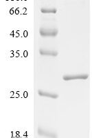 Bovine Interleukin-1 alpha (IL1A) Recombinant Protein - BioCrest Sci