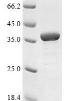 Human Chemokine-like receptor 1 (CMKLR1), partial Recombinant Protein - BioCrest Sci
