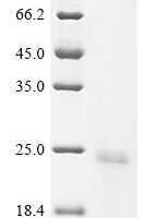 Tobacco mosaic virus Capsid protein (CP) Recombinant Protein, C-His, aa 2–159, Yeast - BioCrest Sci