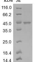 Measles virus Nucleoprotein (N), partial Recombinant Protein, N-10His - BioCrest Sci