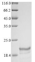 Sudan ebolavirus Envelope glycoprotein (GP), partial Recombinant Protein, N-His-KSI - BioCrest Sci