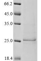 Bat coronavirus HKU3 Spike glycoprotein (S), partial Recombinant Protein - BioCrest Sci