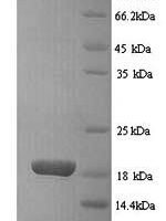 Rat Basic leucine zipper transcriptional factor ATF-like 3 (Batf3) Recombinant Protein, N-His, aa 1–133, Yeast - BioCrest Sci