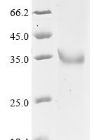 Human L-lactate dehydrogenase C chain (LDHC), partial Recombinant Protein, N-10His - BioCrest Sci