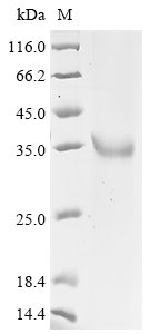 Human L-lactate dehydrogenase C chain (LDHC), partial Recombinant Protein, N-10His, Homo sapiens (Human), Baculovirus, N-terminal 10xHis-tagged, 38.7 kDa, purity >≥ 90% as determined by SDS-PAGE.