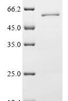 Human Vacuolar protein sorting-associated protein 4A (VPS4A) Recombinant Protein - BioCrest Sci