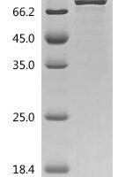 Mouse Sarcosine dehydrogenase, mitochondrial (Sardh), partial Recombinant Protein, N-10His/C-Myc - BioCrest Sci