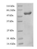 Escherichia coli Vitamin B12-binding protein (btuF), partial Recombinant Protein, N-GST - BioCrest Sci
