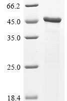Human CMRF35-like molecule 8 (CD300A), partial Recombinant Protein - BioCrest Sci