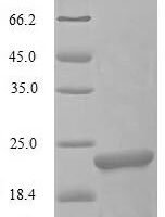 Oncorhynchus keta L-rhamnose-binding lectin CSL3 Recombinant Protein - BioCrest Sci