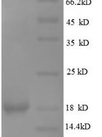 Human Leptin (LEP), partial Recombinant Protein - BioCrest Sci