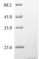 Chicken Fibroblast growth factor 2 (FGF2) Recombinant Protein, N-10His - BioCrest Sci