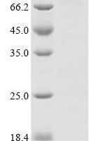 Arabidopsis thaliana Twinkle homolog protein, chloroplastic/mitochondrial Recombinant Protein, C-His - BioCrest Sci