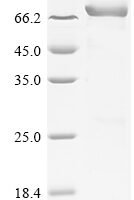 Human Mixed lineage kinase domain-like protein (MLKL) Recombinant Protein, N-10His-SUMO - BioCrest Sci