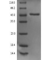 Rat Alpha-1-antiproteinase (Serpina1) Recombinant Protein - BioCrest Sci