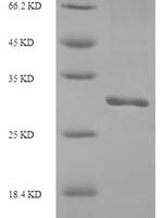 Human Inter-alpha-trypsin inhibitor heavy chain H5 (ITIH5), partial Recombinant Protein - BioCrest Sci