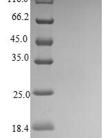 Human C-X-C motif chemokine 10 (CXCL10) Recombinant Protein, C-His - BioCrest Sci