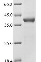Human Epididymal secretory glutathione peroxidase (GPX5) Recombinant Protein - BioCrest Sci