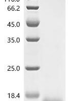 Human Coagulation factor X (F10), partial Recombinant Protein, C-10His, aa 86–165 - BioCrest Sci