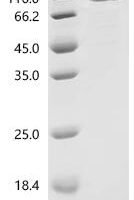 Mouse Growth/differentiation factor 9 (Gdf9) Recombinant Protein, C-10His-HSA - BioCrest Sci