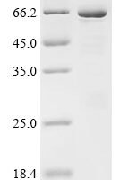 Human Polypyrimidine tract-binding protein 1 (PTBP1) Recombinant Protein, N-His/C-Avi - BioCrest Sci