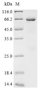 Human Polypyrimidine tract-binding protein 1 (PTBP1) Recombinant Protein, N-His/C-Avi, Homo sapiens (Human), E.coli, N-terminal 6xHis-tagged and C-terminal Avi-tagged, 68.3 kDa, purity >≥ 85% as determined by SDS-PAGE.
