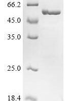 Human Peroxisome proliferator-activated receptor delta (PPARD), partial Recombinant Protein - BioCrest Sci