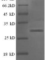 Human Islet amyloid polypeptide protein (IAPP), partial Recombinant Protein - BioCrest Sci