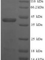Human Vesicle transport through interaction with t-SNAREs homolog 1B (VTI1B), partial Recombinant Protein - BioCrest Sci