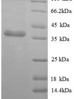 Human Protein BEX3 (NGFRAP1) Recombinant Protein, N-GST - BioCrest Sci