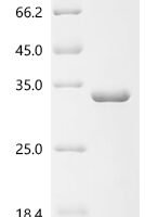 Human Probable global transcription activator SNF2L2 (SMARCA2), partial Recombinant Protein, C-His - BioCrest Sci