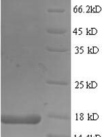 Mouse Frataxin, mitochondrial (Fxn), partial Recombinant Protein - BioCrest Sci