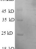 Human Hexokinase-1 (HK1) Recombinant Protein - BioCrest Sci