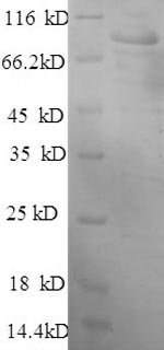 Human Hexokinase-1 (HK1) Recombinant Protein, Homo sapiens (Human), E.coli, N-terminal 6xHis-tagged, 106.5 kDa, purity >≥ 90% as determined by SDS-PAGE.
