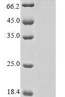 Human Mi-2 autoantigen 240 kDa protein, partial Recombinant Protein - BioCrest Sci