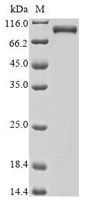 Human Mi-2 autoantigen 240 kDa protein, partial Recombinant Protein, Homo sapiens (Human), Baculovirus, N-terminal 10xHis-tagged, 73.5 kDa, purity >≥ 85% as determined by SDS-PAGE.