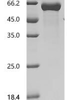 Human E3 ubiquitin-protein ligase XIAP (XIAP) Recombinant Protein, C-His - BioCrest Sci