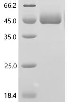 Human Signal-regulatory protein gamma (SIRPG), partial Recombinant Protein, C-10His - BioCrest Sci