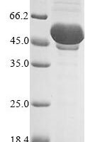 Vaccinia virus Truncated plaque-size/host range protein (PS/HR) Recombinant Protein, N-MBP/C-His - BioCrest Sci