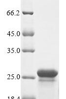 Human Gamma-crystallin B (CRYGB) Recombinant Protein - BioCrest Sci