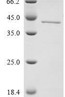 Human Protein ABHD11 (ABHD11) Recombinant Protein - BioCrest Sci