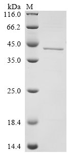 Human Protein ABHD11 (ABHD11) Recombinant Protein, Homo sapiens (Human), E.coli, C-terminal 6xHis-tagged, 41.6 kDa, purity >≥ 85% as determined by SDS-PAGE.
