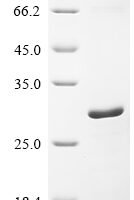 Human Cell surface glycoprotein CD200 receptor 1 (CD200R1), partial Recombinant Protein - BioCrest Sci