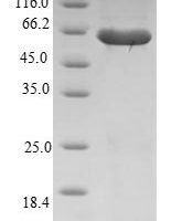 Human Ras association domain-containing protein 6 (RASSF6) Recombinant Protein - BioCrest Sci